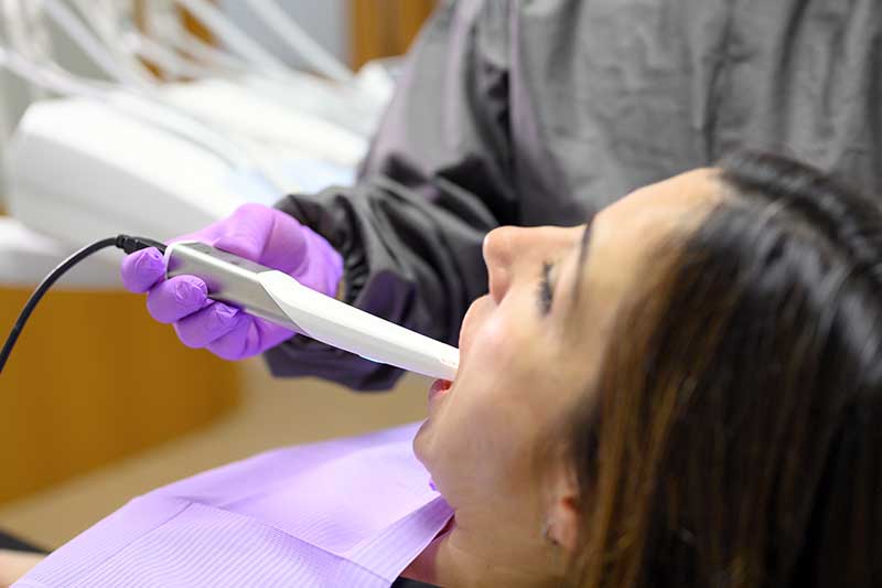 Intra-Oral Scanner in Mission Viejo